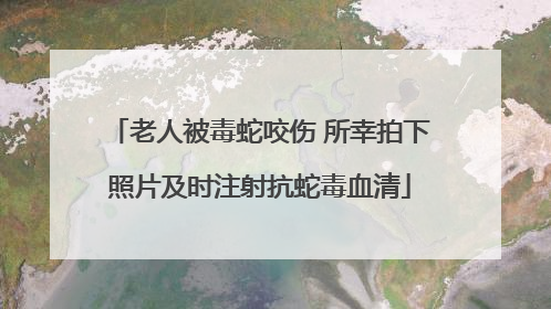 老人被毒蛇咬伤 所幸拍下照片及时注射抗蛇毒血清